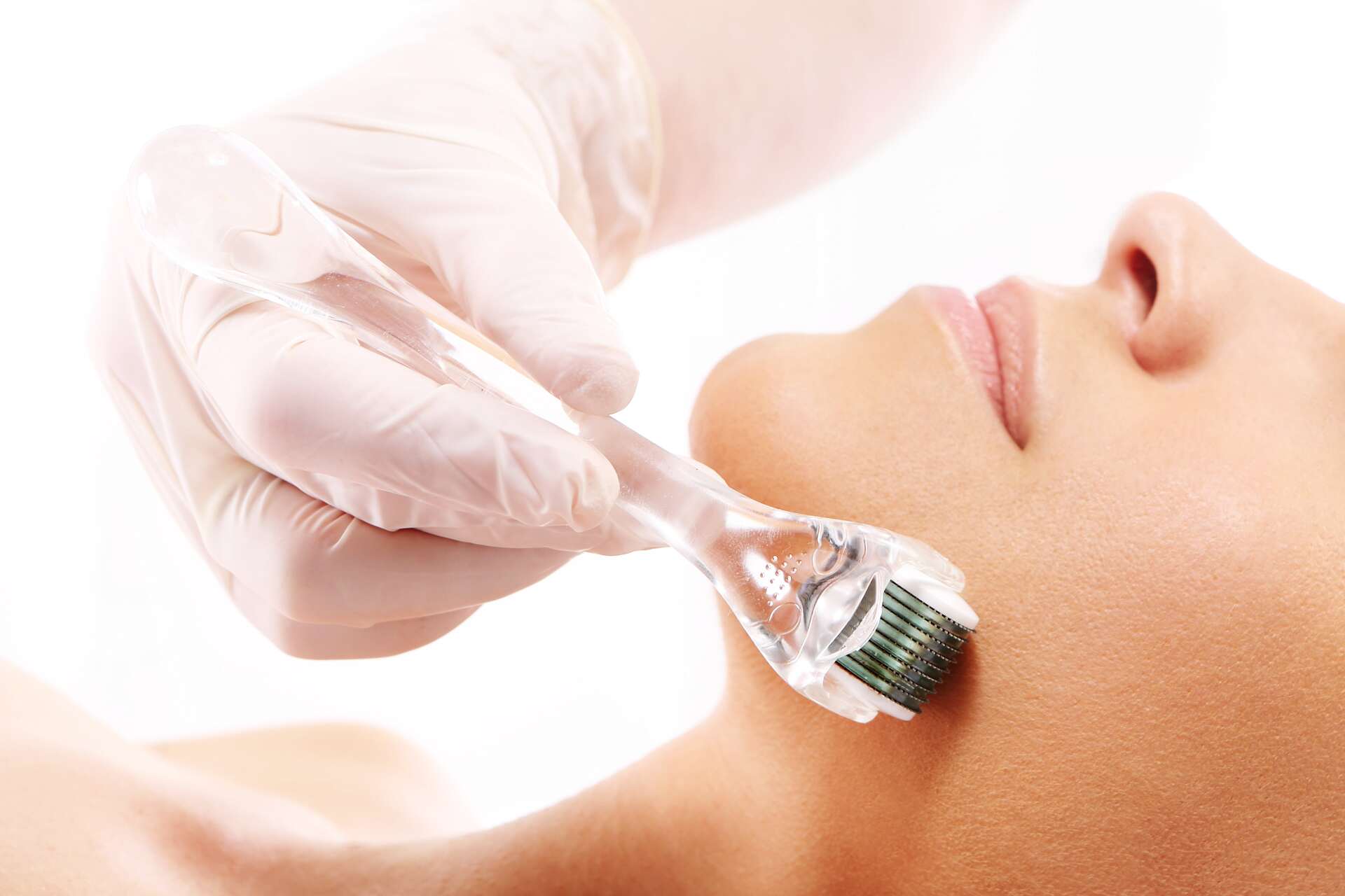 Skin Needling — Beauty Salon in Anula, NT