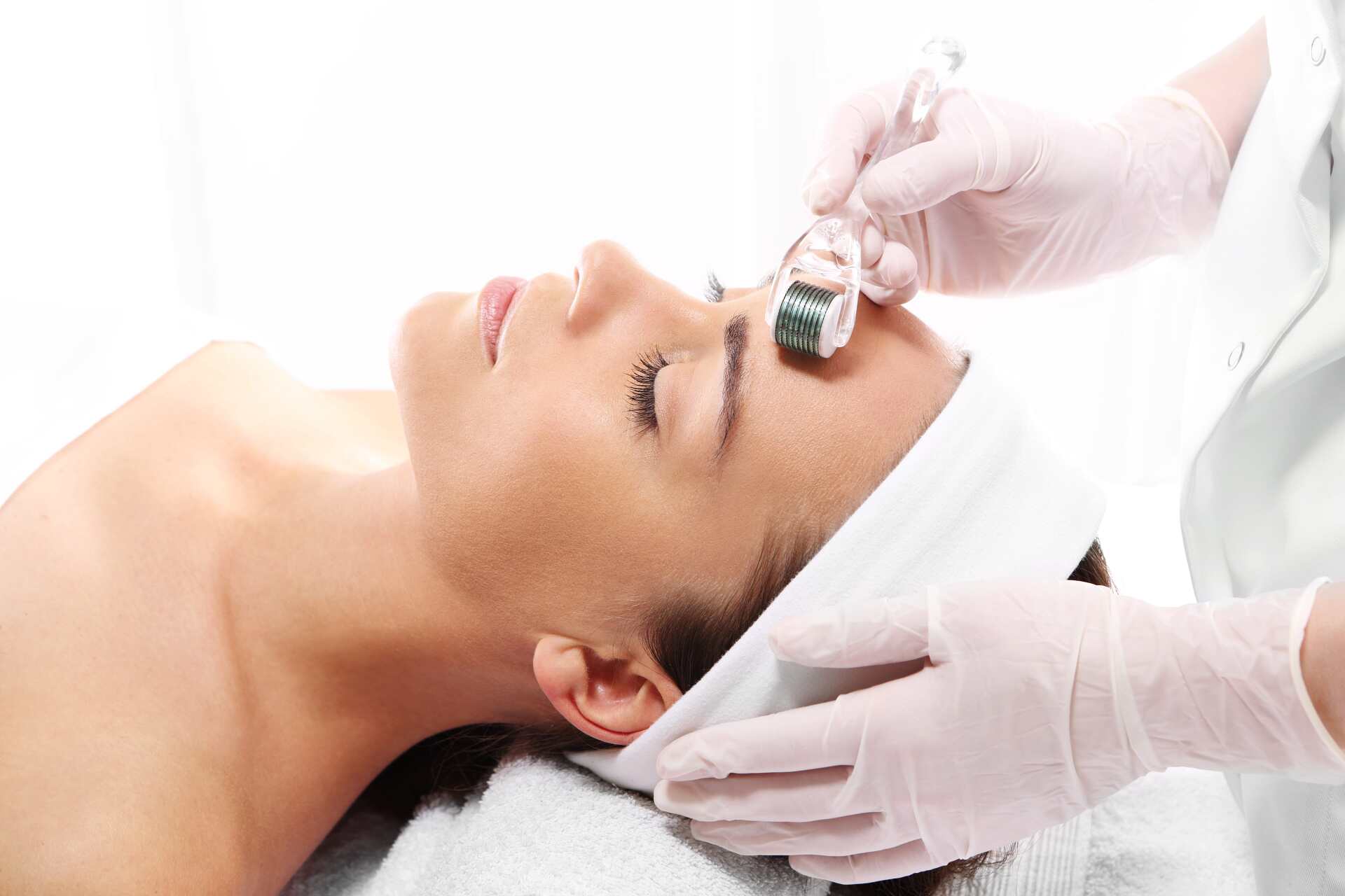 Skin Needling Procedure — Beauty Salon in Anula, NT