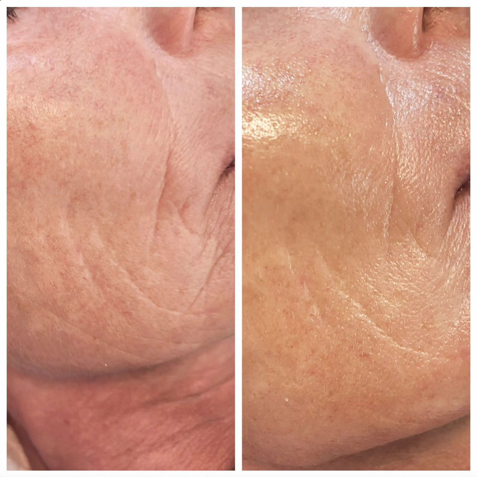 Ein Vorher-Nachher-Foto des Gesichts einer Frau.