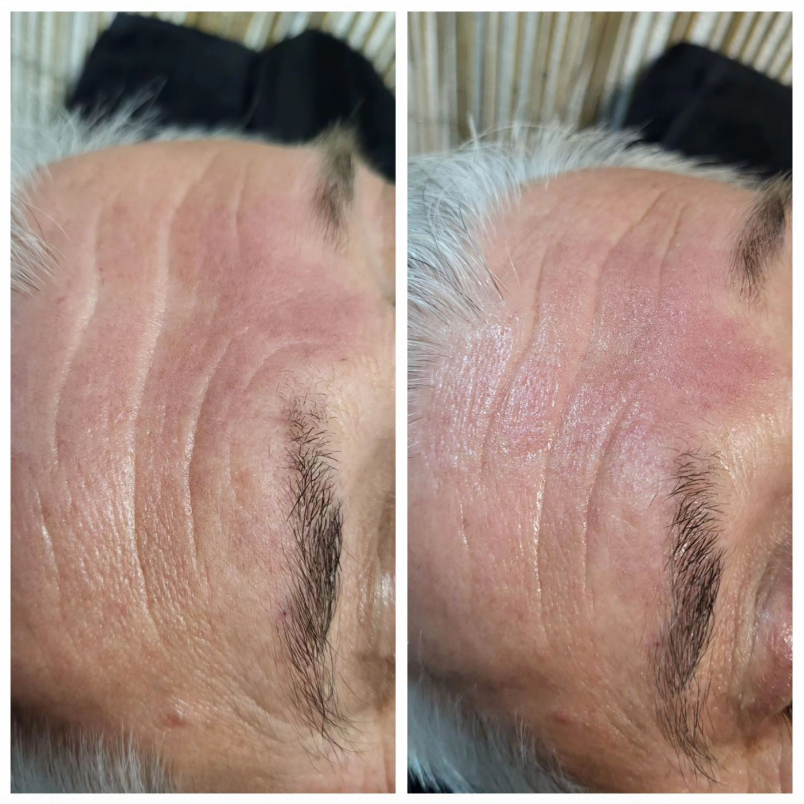 Ein Vorher-Nachher-Foto des Gesichts eines Mannes.