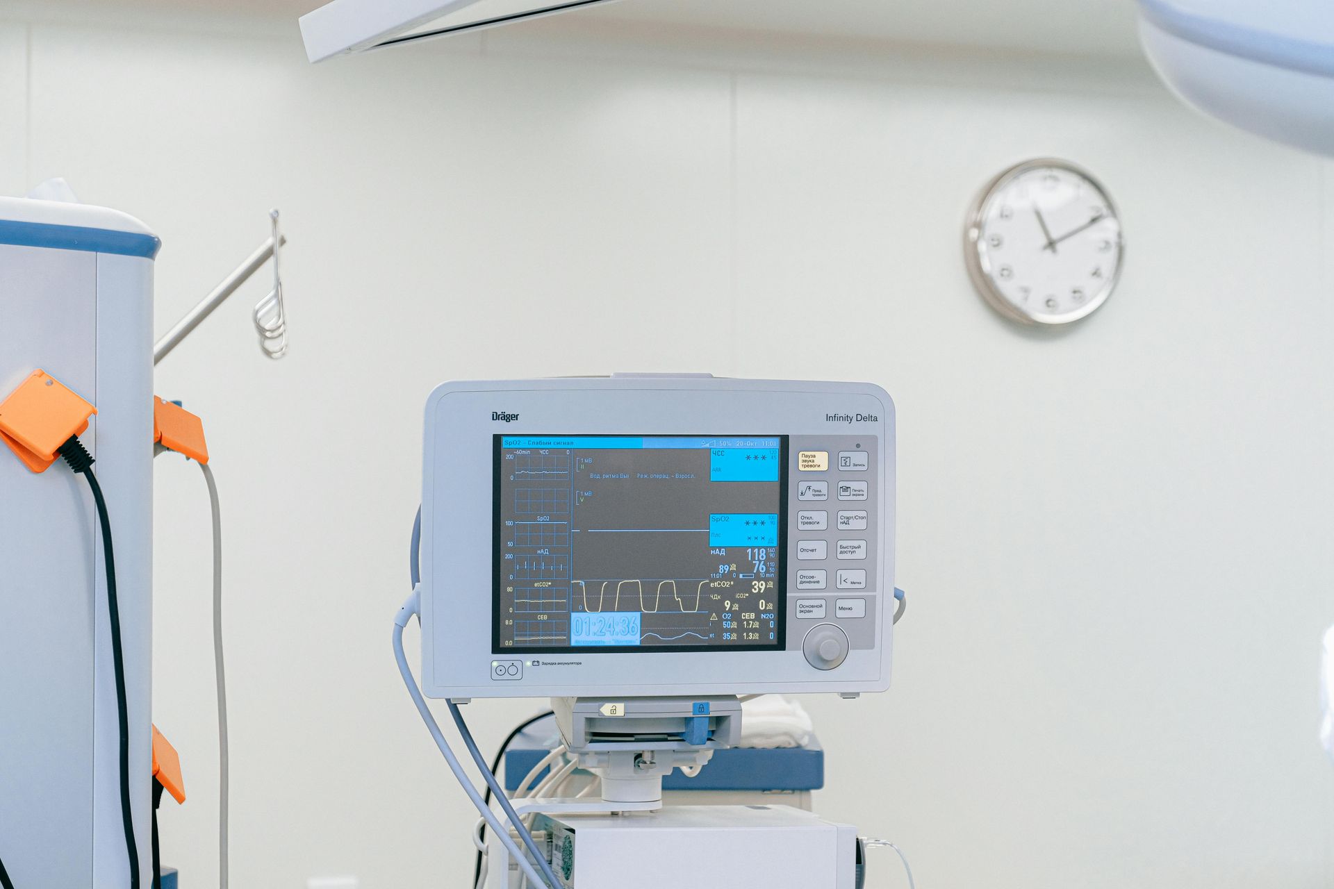 Monitor médico em uma sala de cirurgia, exibindo sinais vitais, com um relógio na parede.