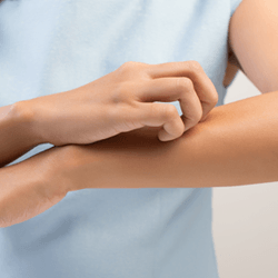 Person Scratching the Arm — Fort Gratiot, MI — Hamzavi Dermatology & Dermatology Specialists
