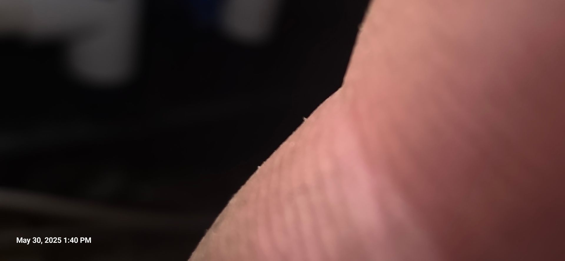 Close-up of a person's skin with a dark blurred background.