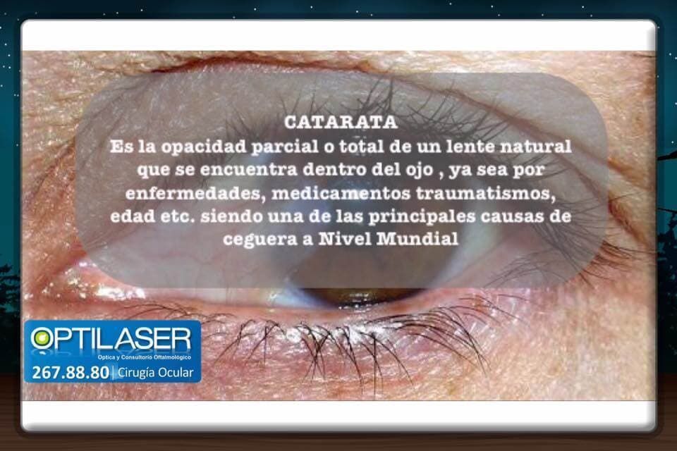 OPTILÁSER - Cataratas