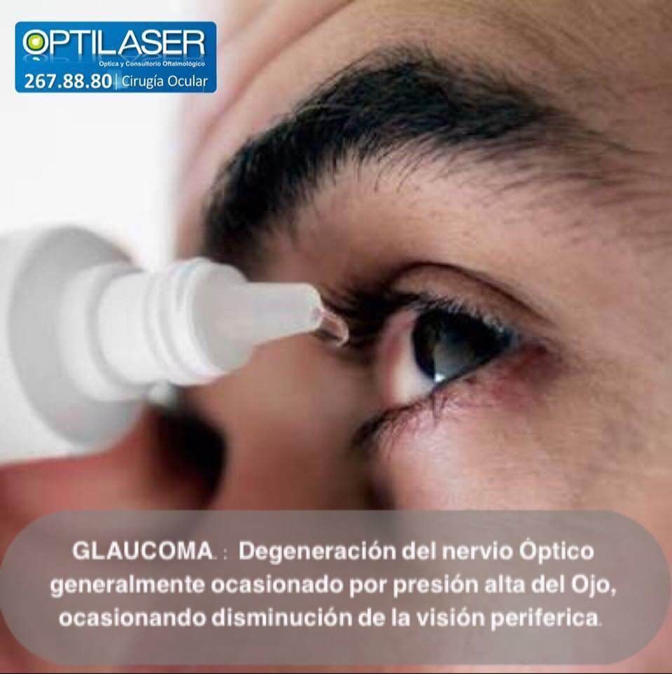 OPTILÁSER - Glaucoma