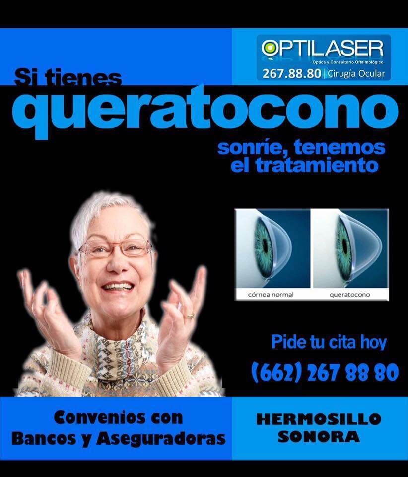 OPTILÁSER - Queratocono
