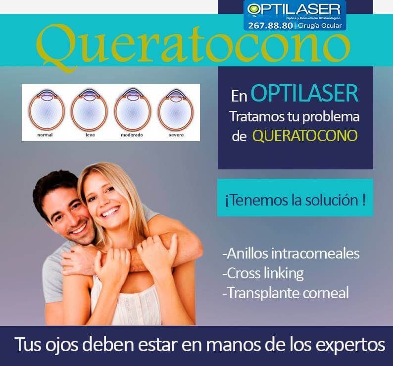 OPTILÁSER - Queratocono