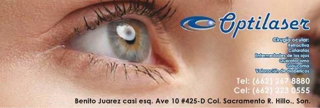 OPTILÁSER - PUBLICIDAD