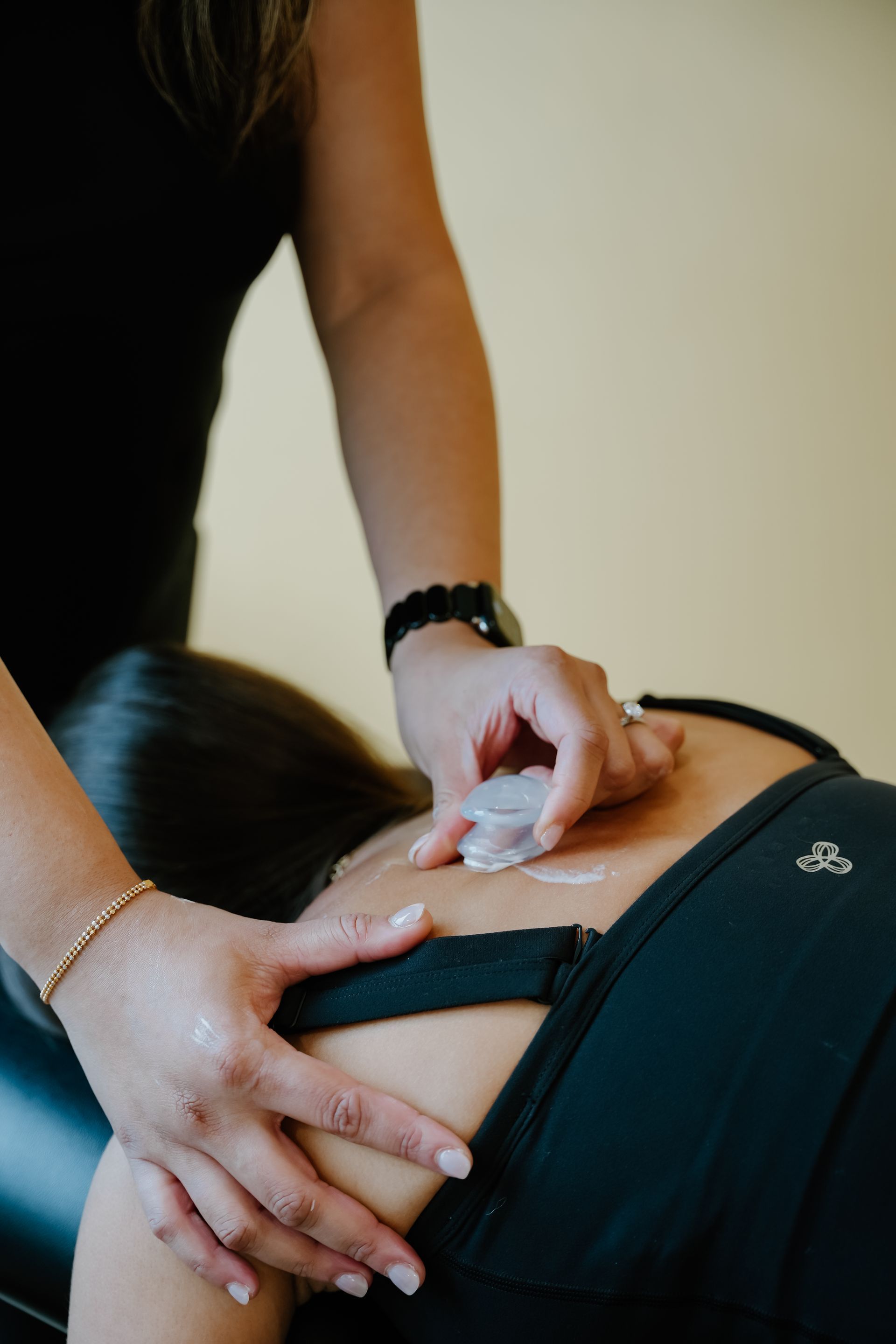 Therapist applying cupping therapy to a person's upper back.ce