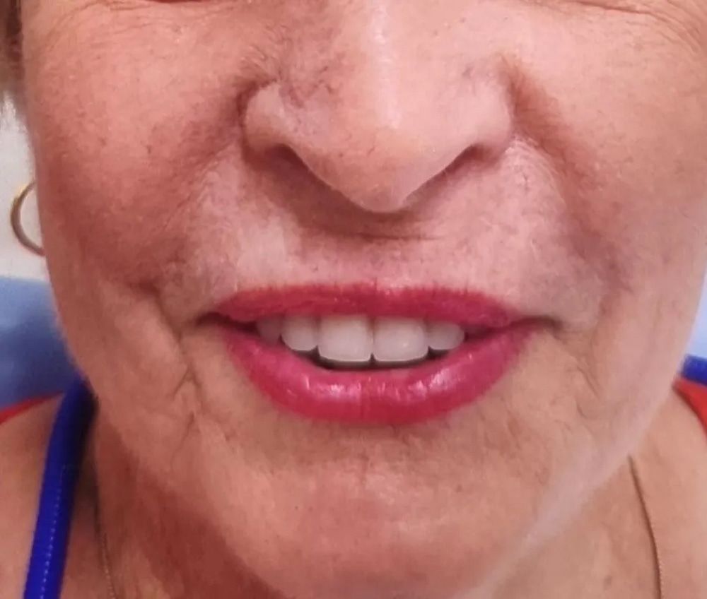 Close-up of Older Woman's Face, Smiling, Showing White Teeth — Smiles on Hudson In Hamilton, NSW
