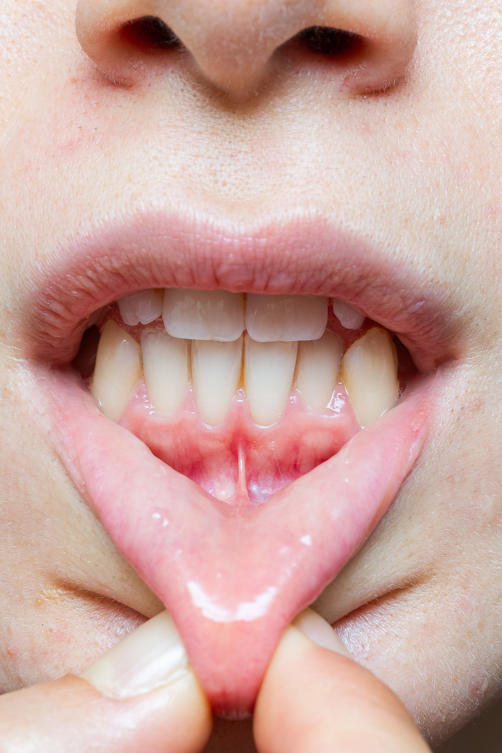 Mouth open, lips pulled down, revealing gums and teeth. Focus on the underside of the upper lip.