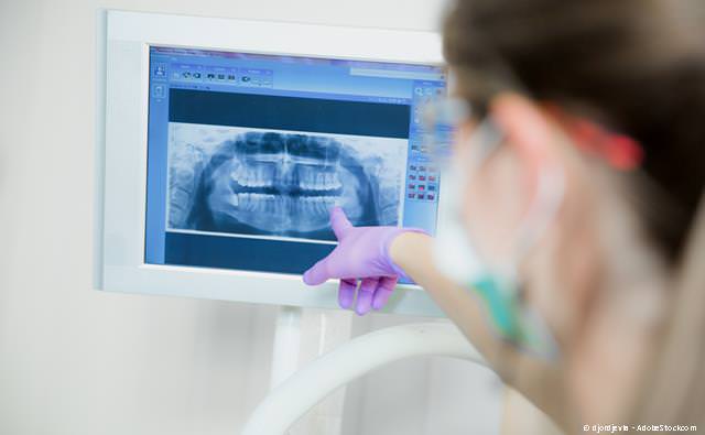 Digitales Röntgen: Weniger Strahlenbelastung und sofort verfügbare Bilder
