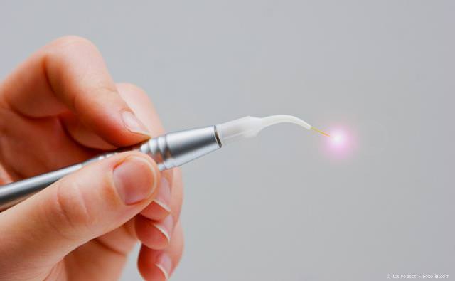 Laser in der Zahnmedizin: Schonende und schmerzarme Behandlung ohne Blutungen