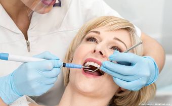 Entfernung von Zahnbelägen unter dem Zahnfleisch bei der Parodontitisbehandlung