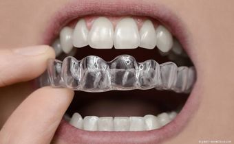 Zahnschiene zur Vermeidung von Störkontakten und zur Harmonisierung des Zahn-Zusammenbisses