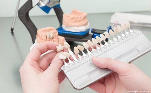 Hochwertiger Zahnersatz Made in Germany aus deutschen Dental-Labors
