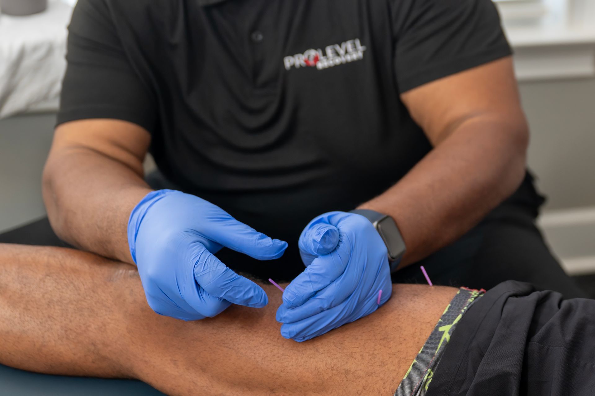 Dry Needling Fayetteville