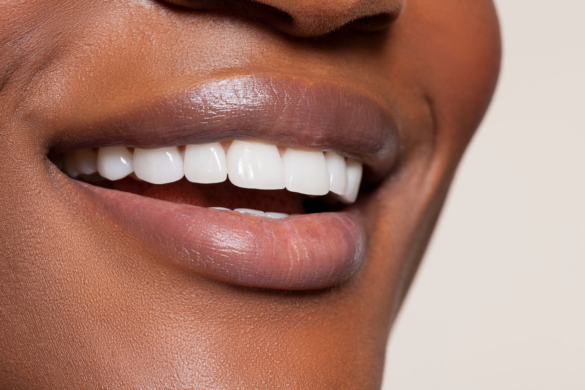 Close-up of smiling mouth with white teeth and glossy, light-colored lips.