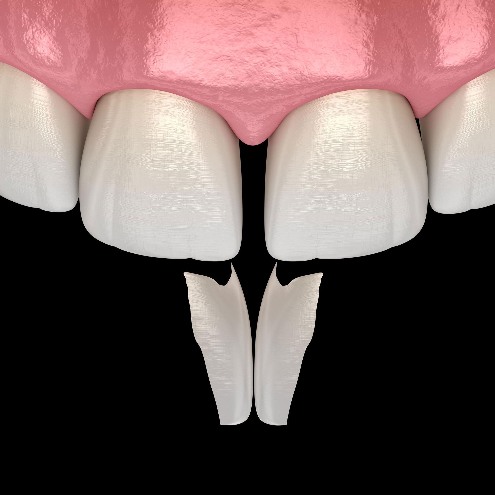 A close up of a person's teeth with a black background