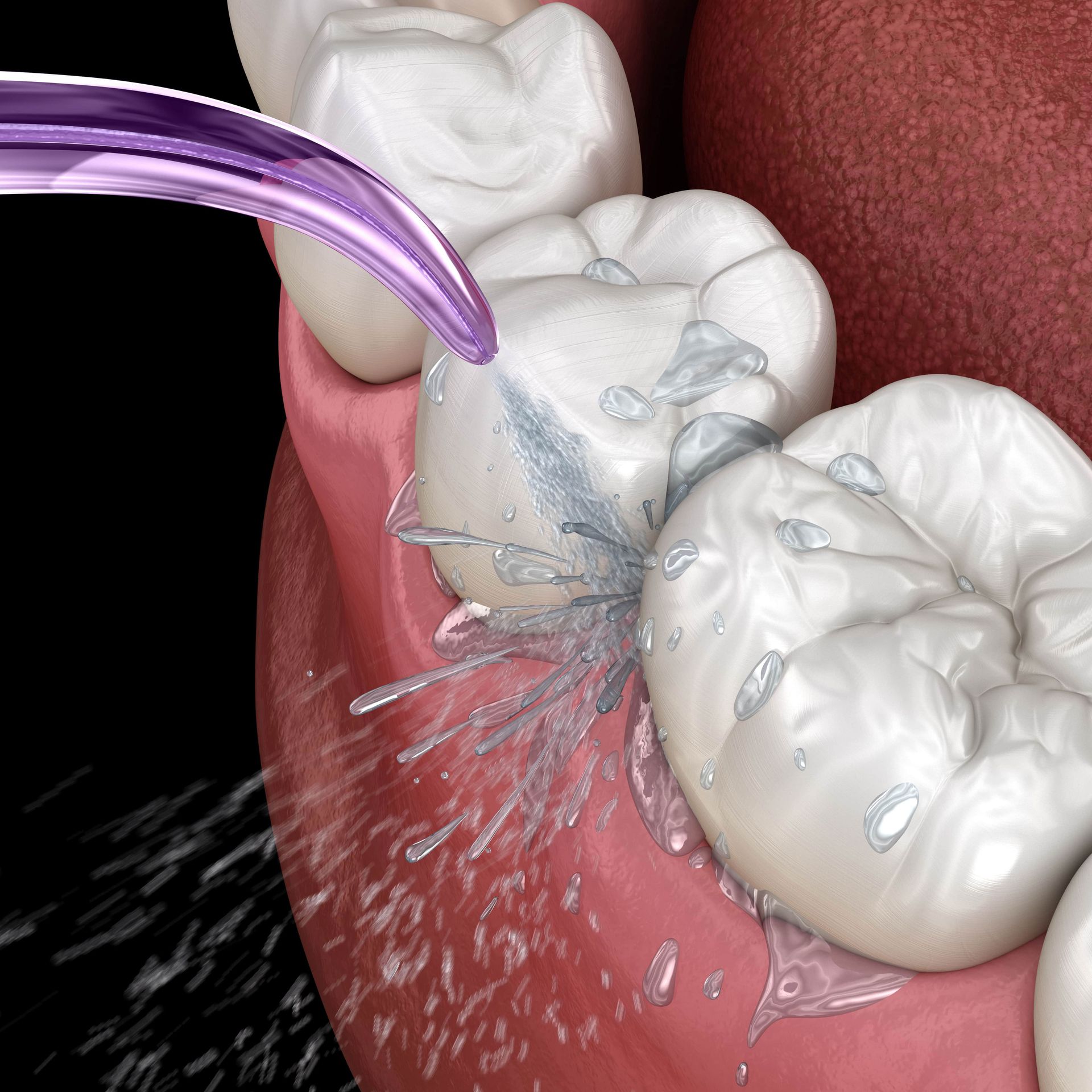 A close up of a person's teeth being cleaned with water