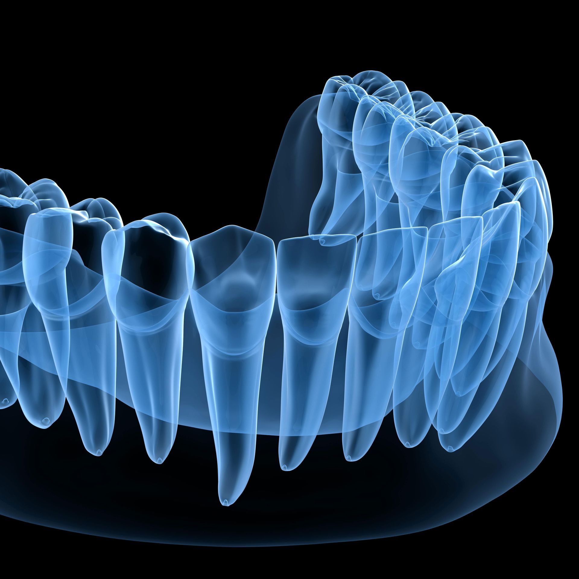 An x-ray of a person's teeth on a black background