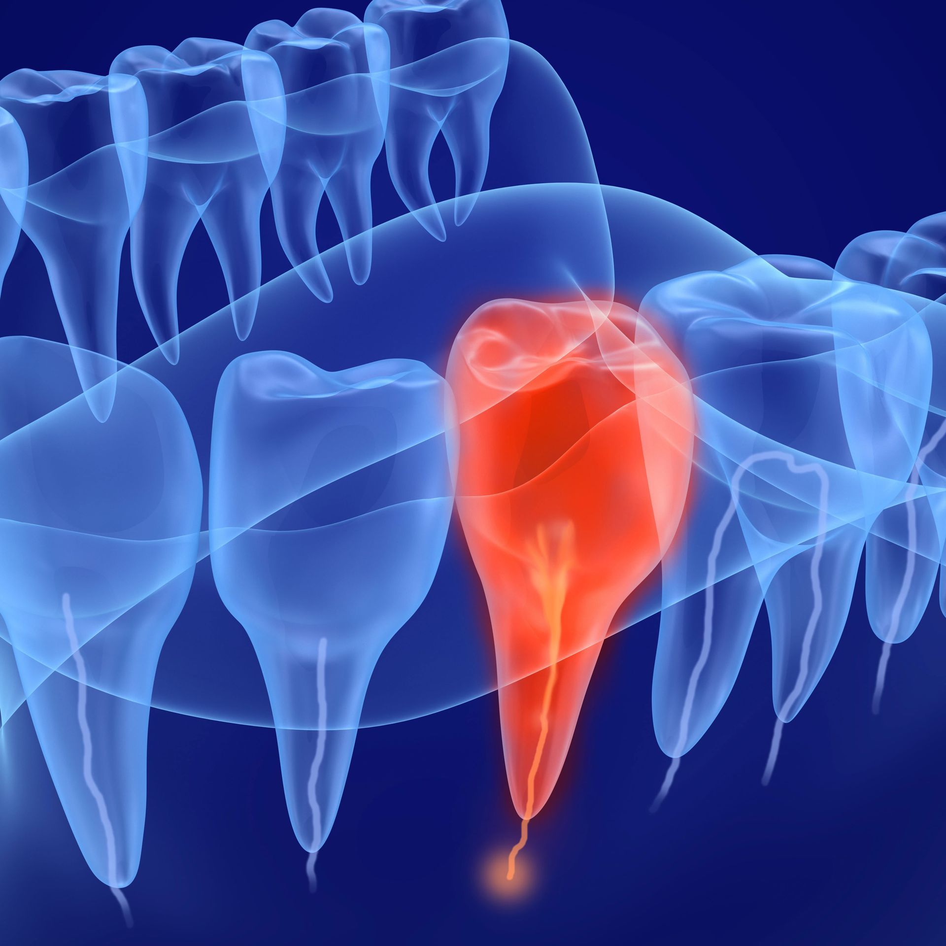 An x-ray of a mouth with a red tooth in the middle