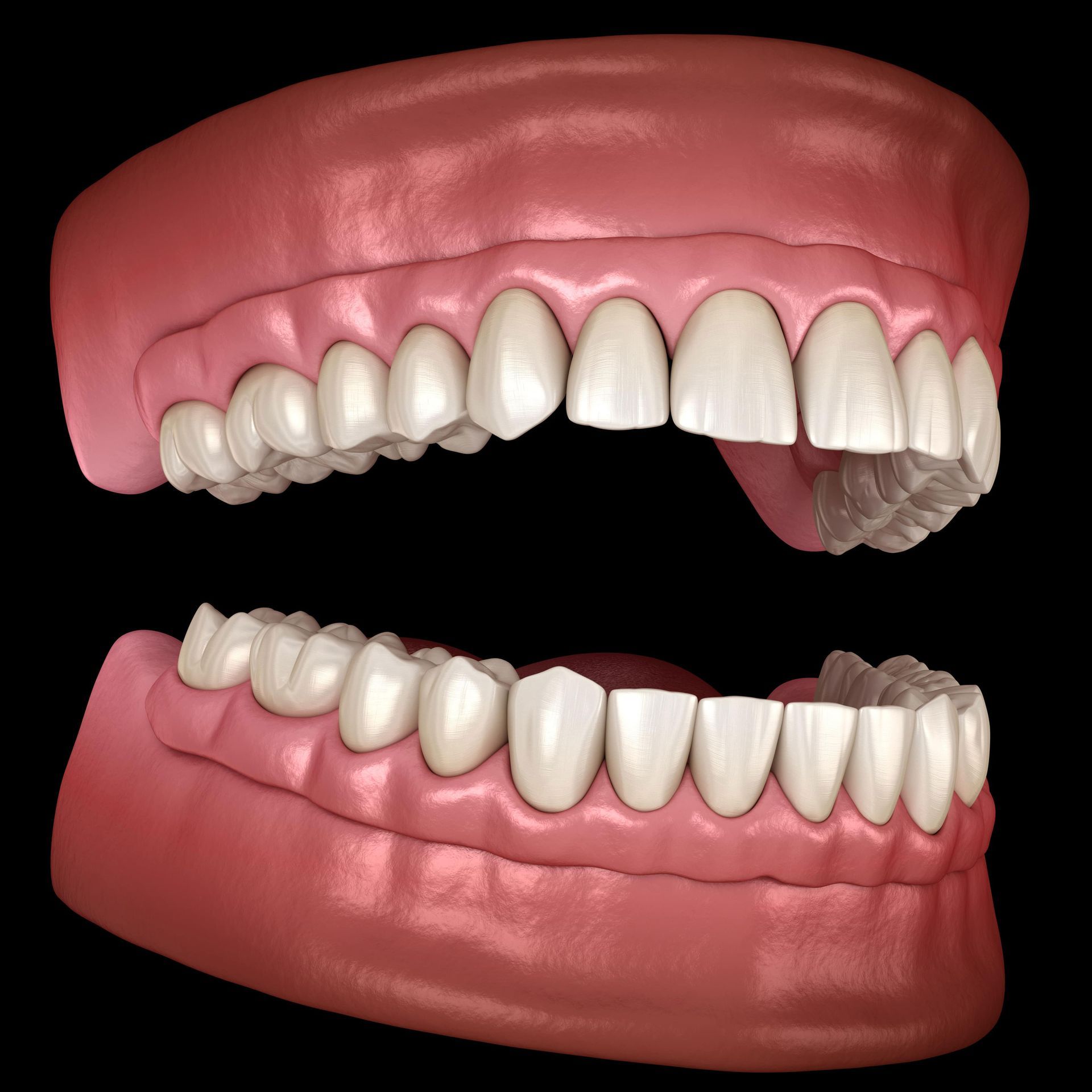 A model of a person's teeth with a black background