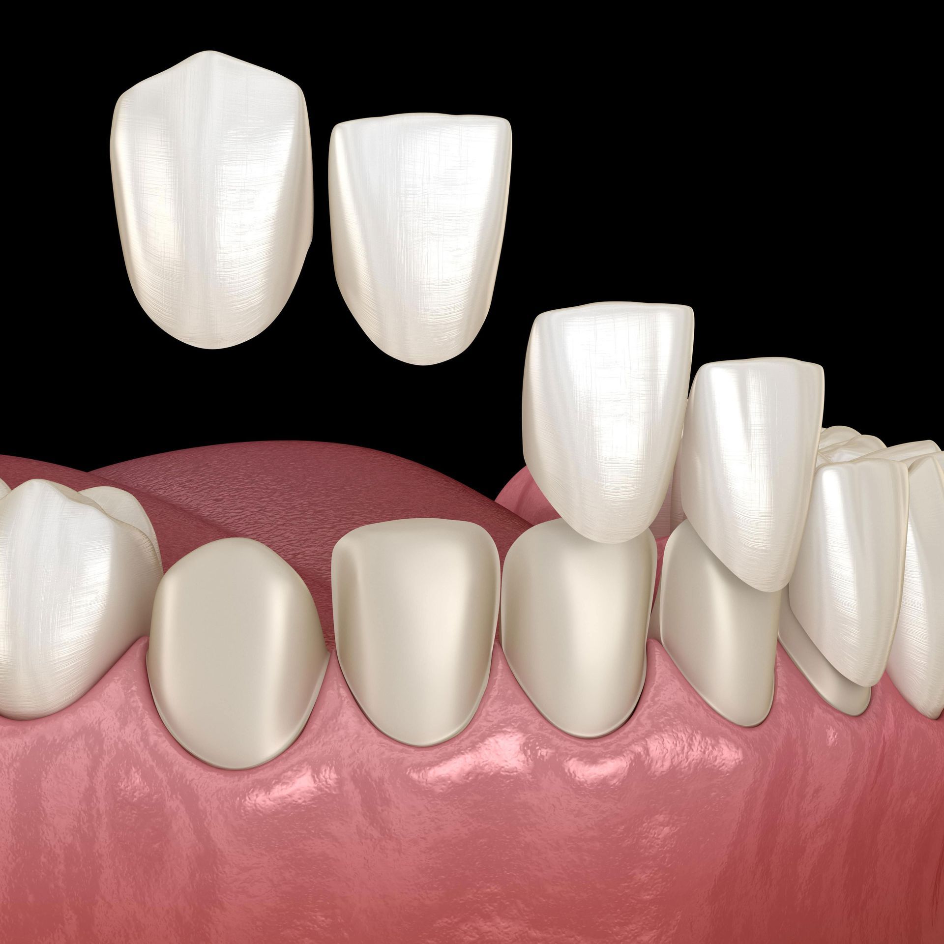 A close up of a person's teeth with a black background