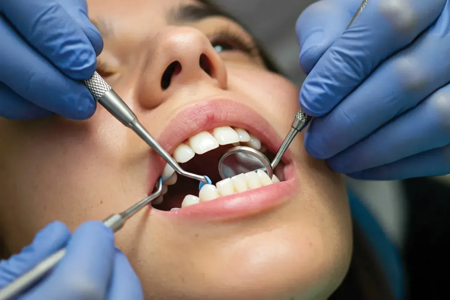 What Is General Dentistry and Why Is It Important?