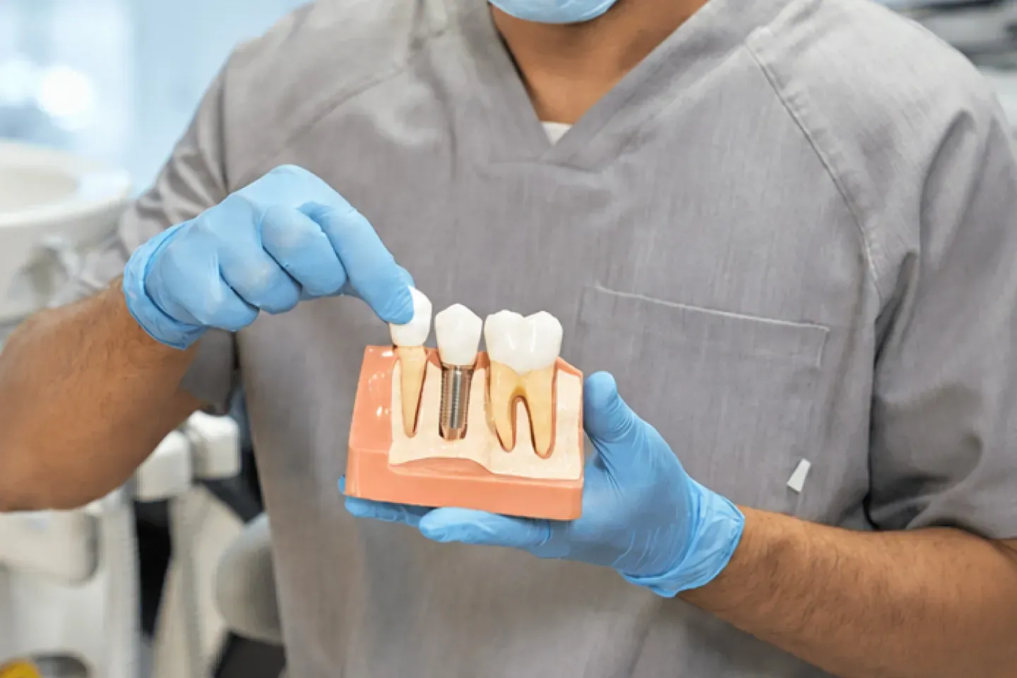 why dental implants are often preferred over dentures