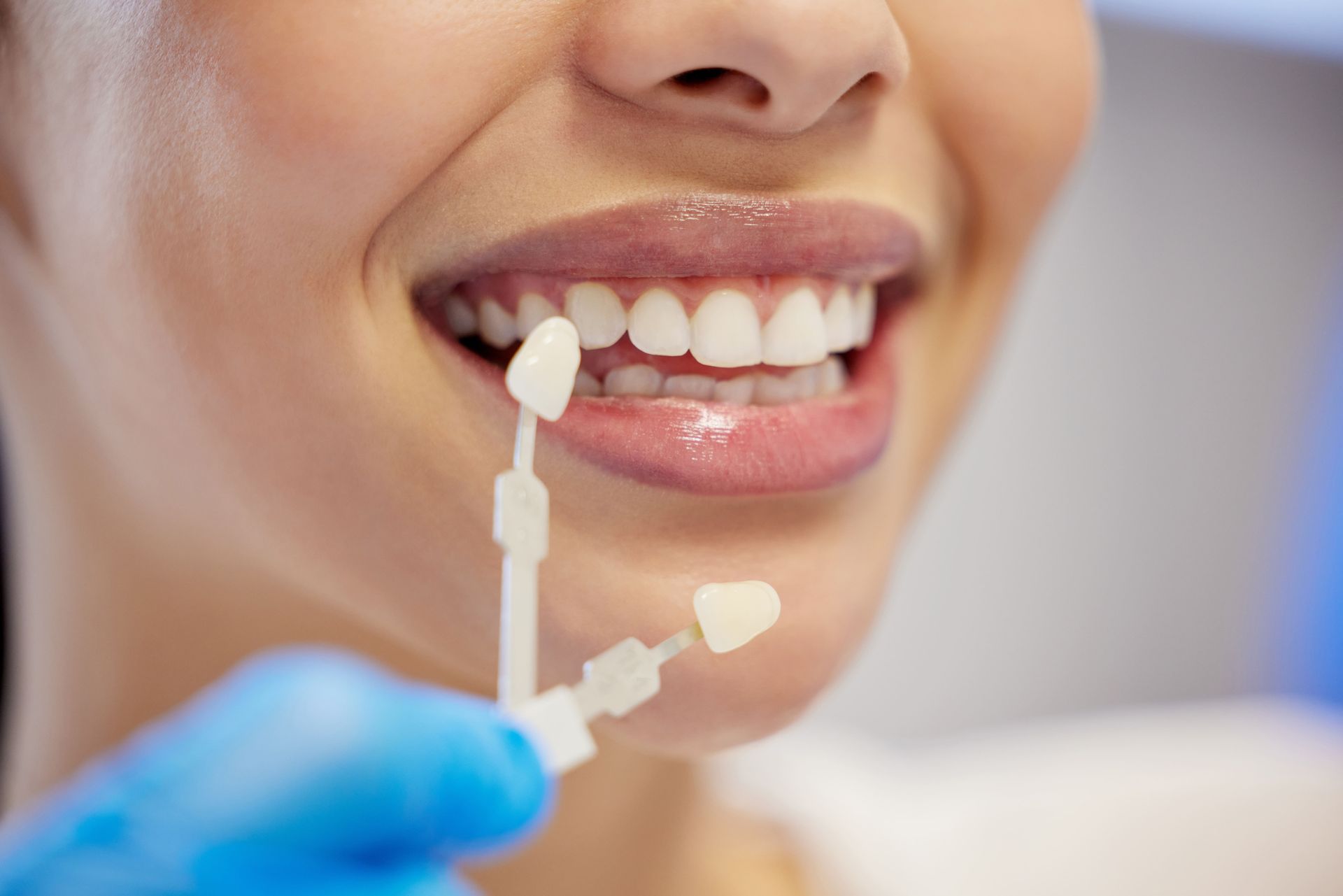 Woman smiling, comparing tooth veneer shades with dentist in blue gloves.
