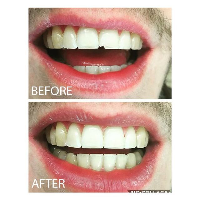 Steliotes Cosmetic Dentistry Results