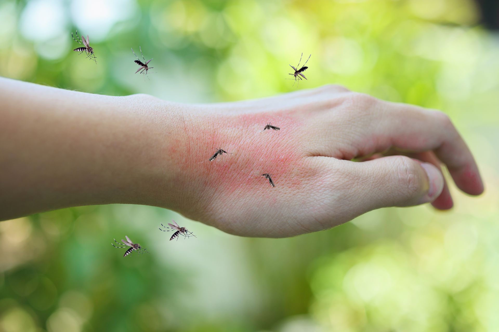 Mosquito bites