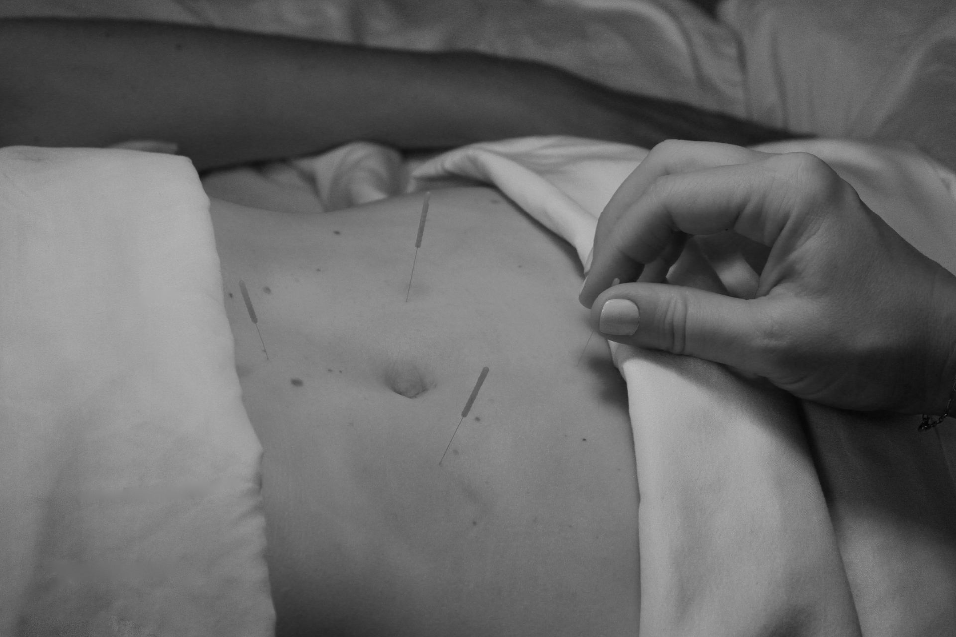 Hand pressing a medical sensor on a patient’s bare abdomen with monitoring electrodes visible
