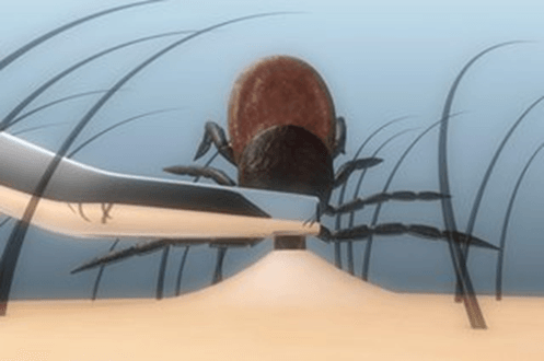 How to remove a tick safely