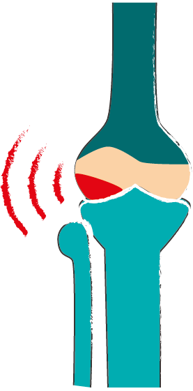 problemi articolari artriti artrosi distorsioni