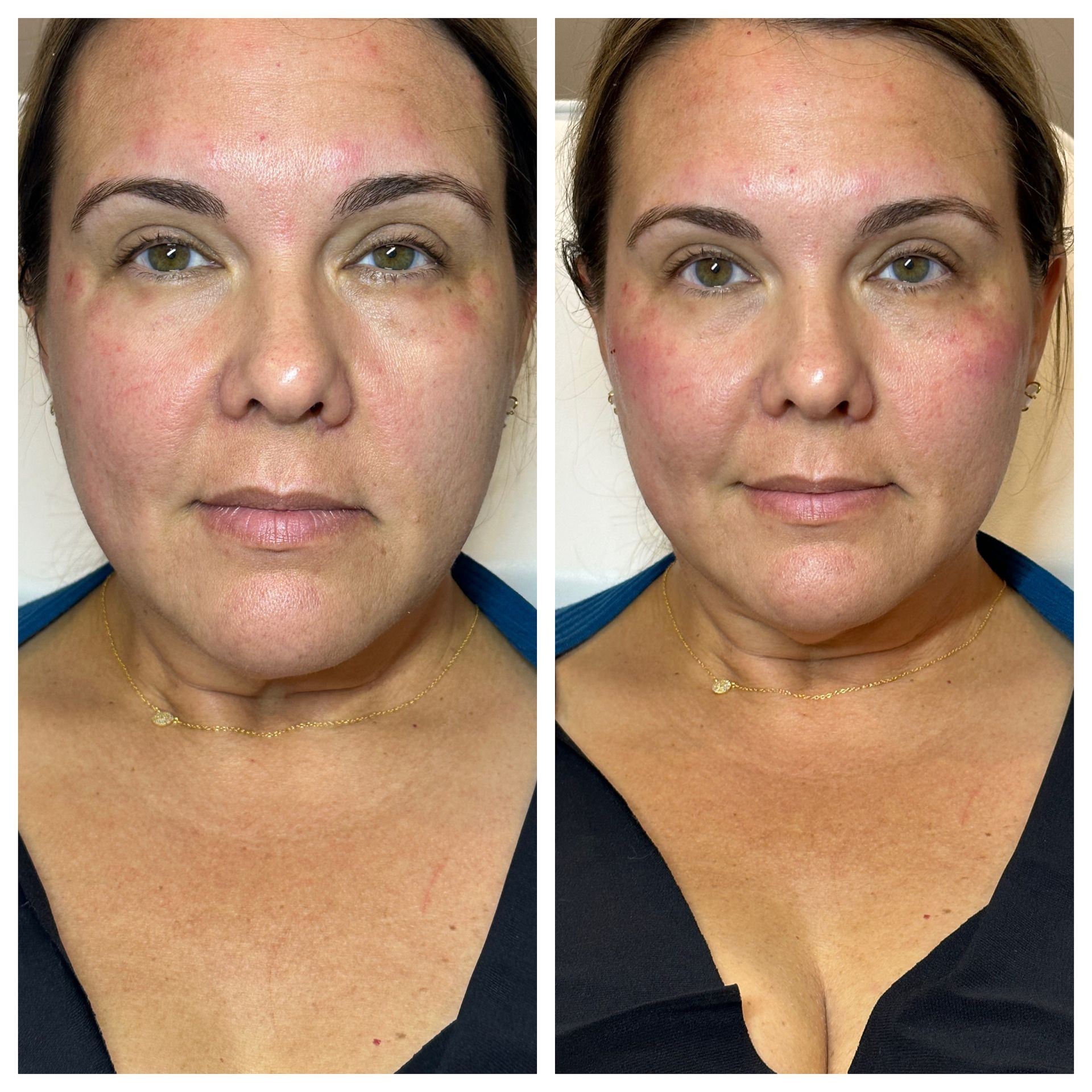 A before and after photo of a woman 's face