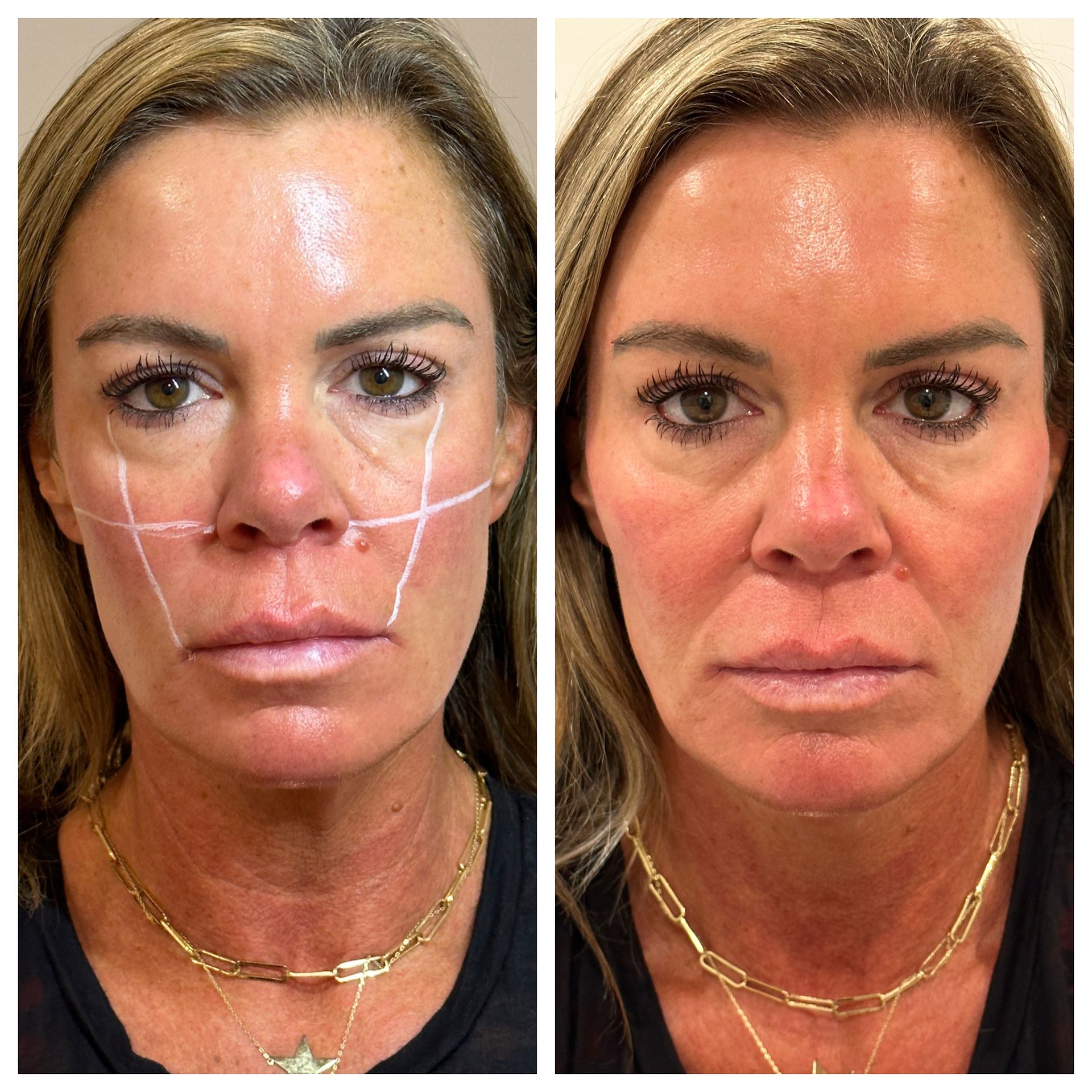 A before and after photo of a woman 's face