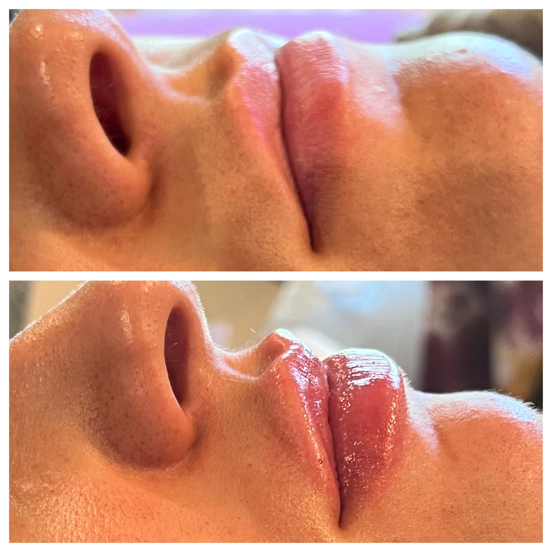 A before and after photo of a woman 's lips.