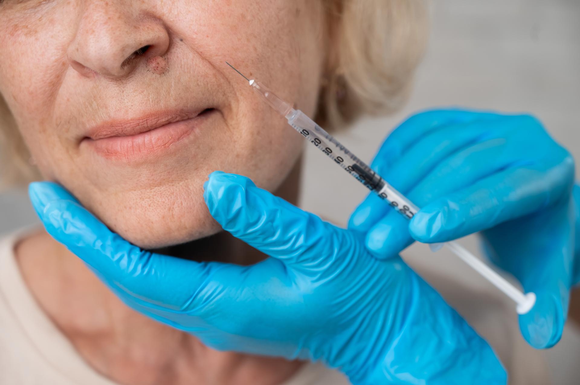 A woman is getting a botox injection in her face.