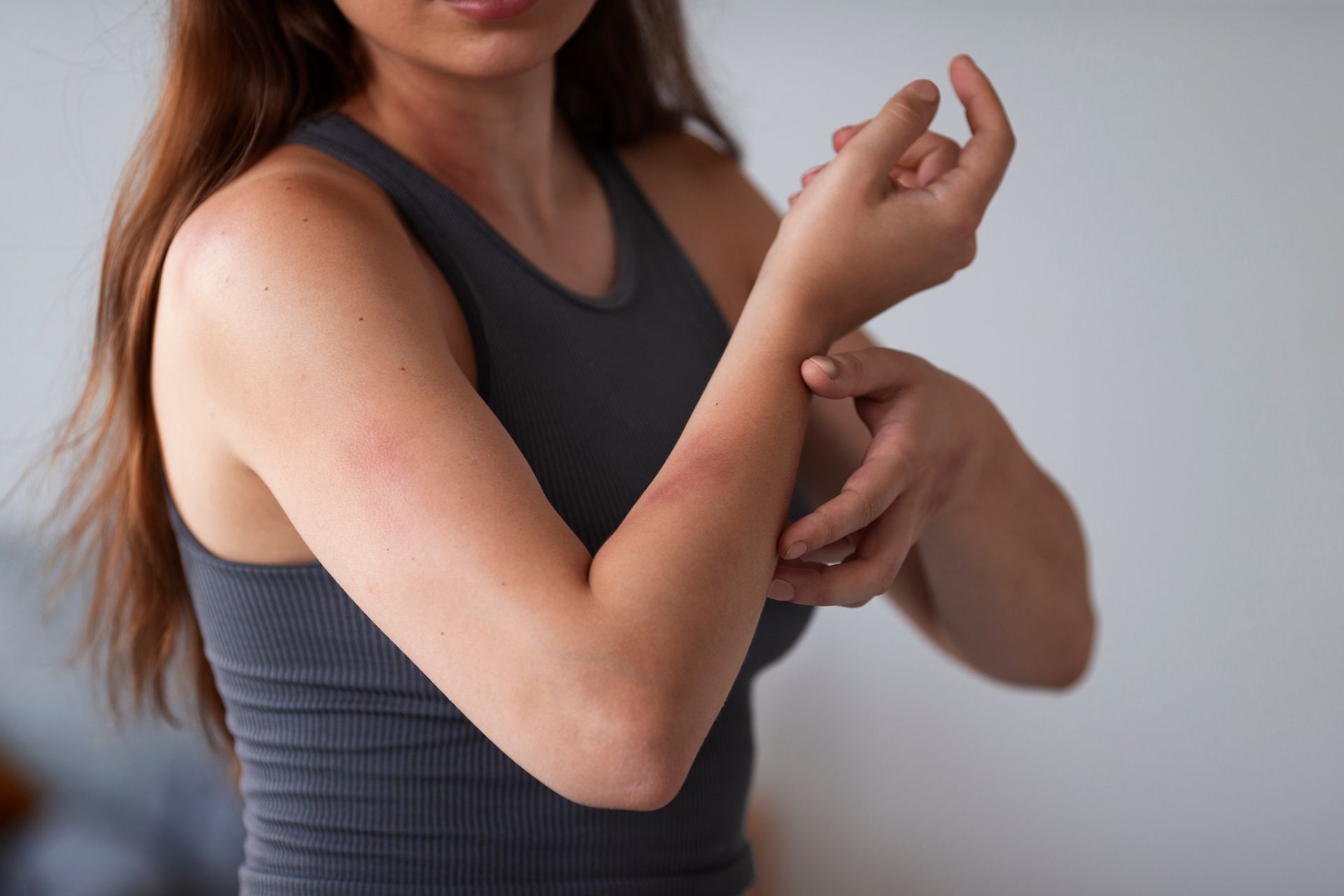 A woman is scratching her arm because of a rash.