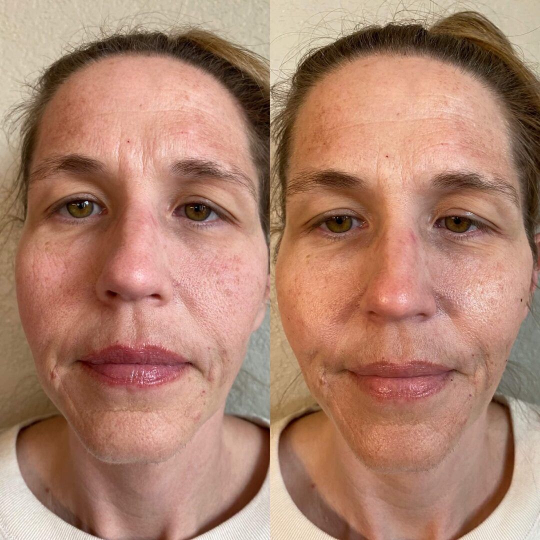 a before and after photo of a woman 's face .