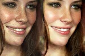 DR. RODOLFO NAVARRO JIMÉNEZ - Dermatólogo