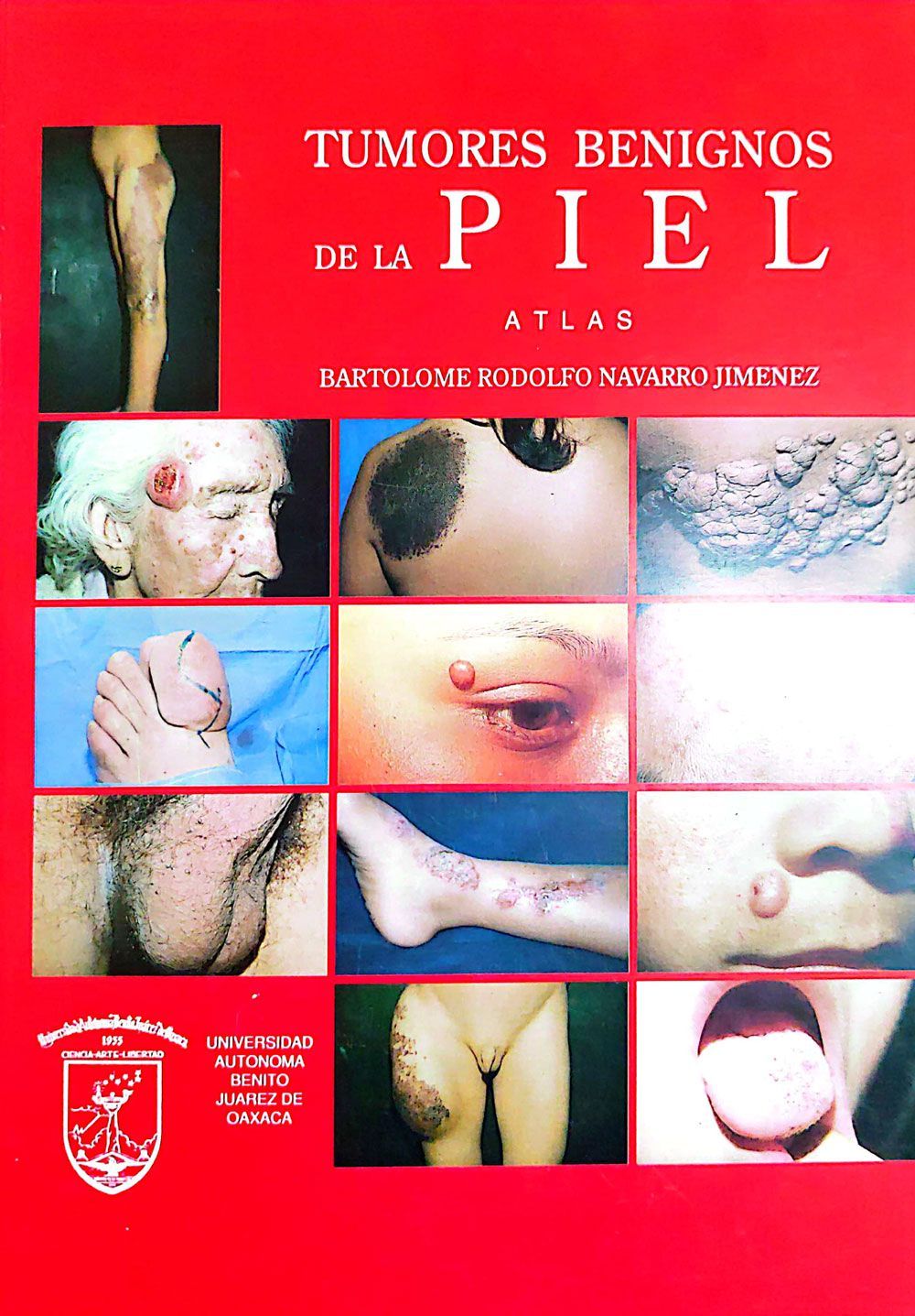 DR. RODOLFO NAVARRO JIMÉNEZ - Libro tumores benignos de la piel