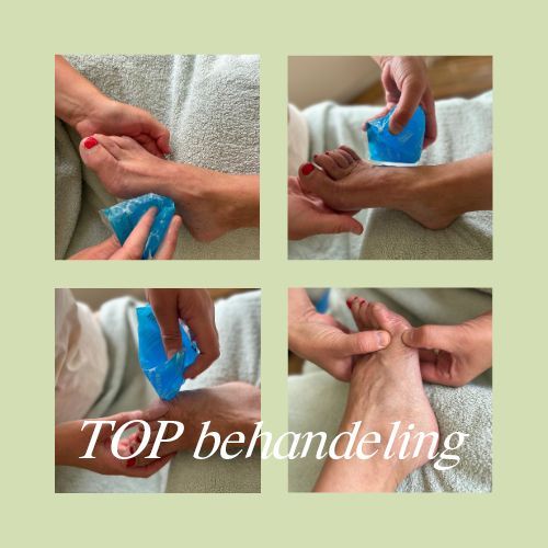 TOP behandeling