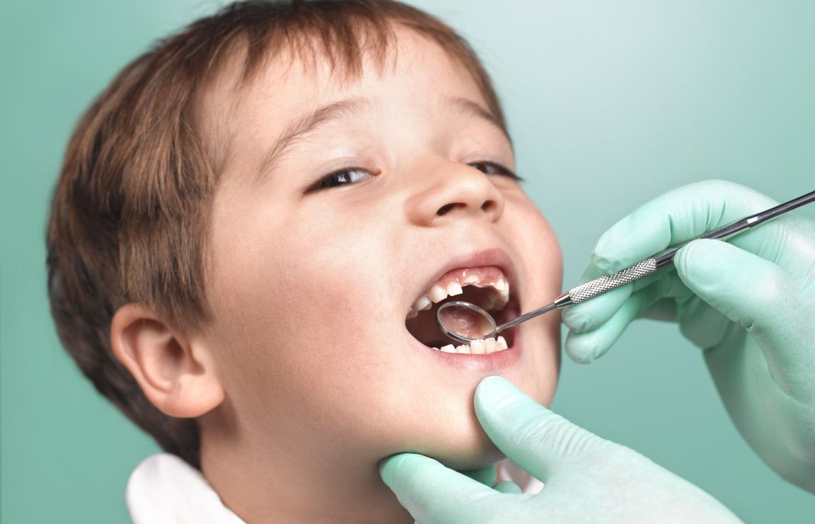 Cure dentistiche pediatriche a Milano