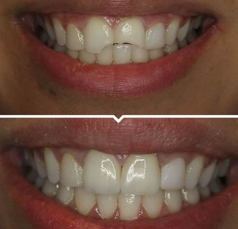 trattamento di urgenza