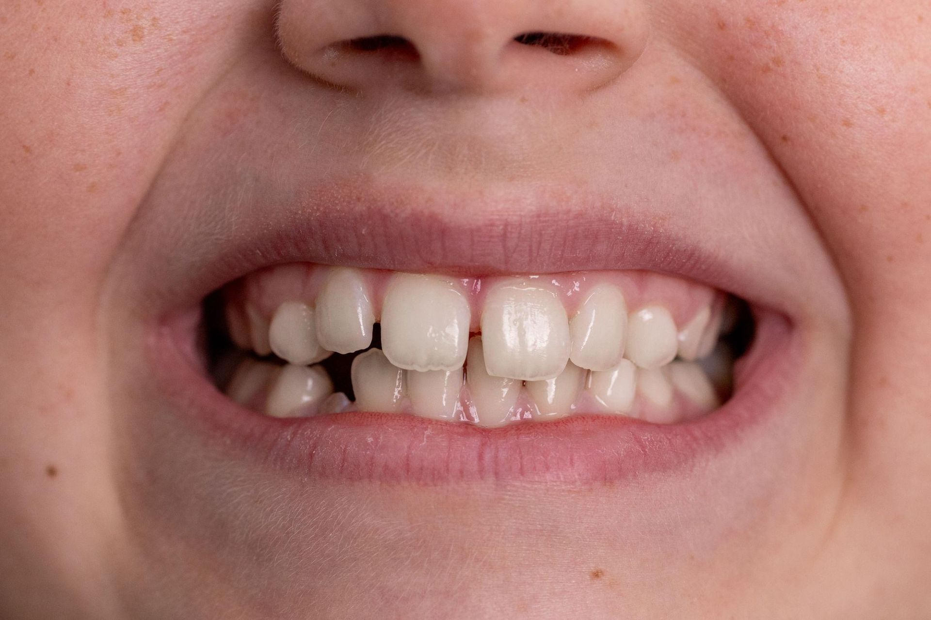 A young boy is getting his teeth examined by a dentist.