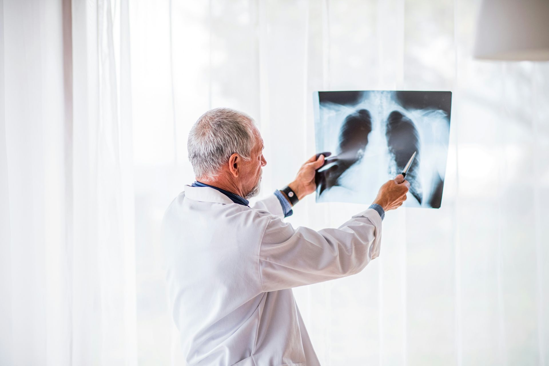 Doctor examines chest X-ray in front of window.