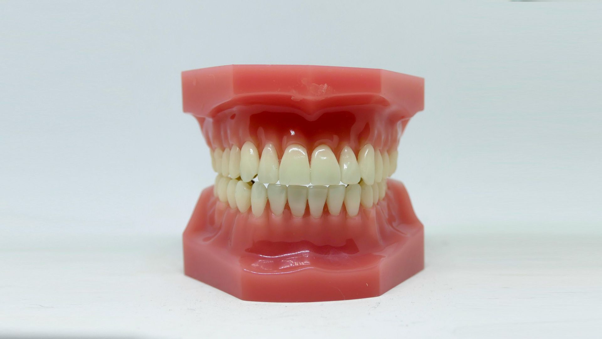 A dental model showing a full set of artificial white teeth set in pink gums against a plain white background.